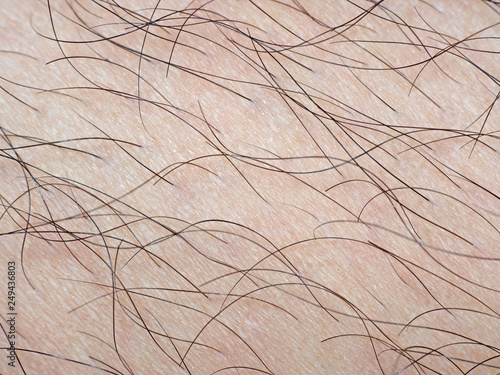 Macro Photo of Human Skin with Hair