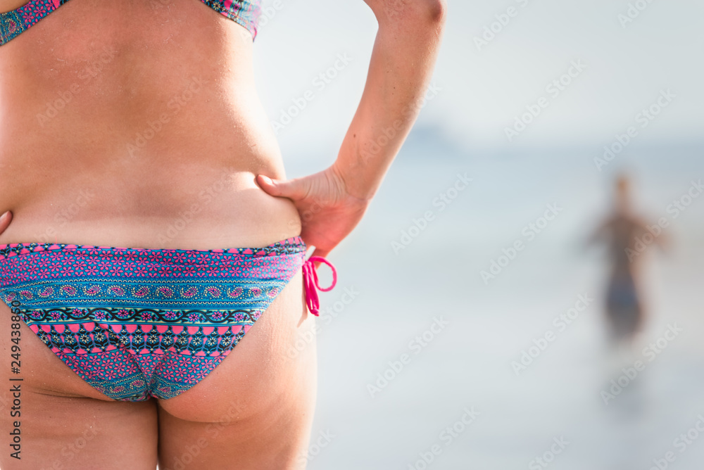 Skin in Sunbathing of young fat women with bikini Swimsuits enjoying the  vacation in water splash on the beach, Symptoms of sunburn, Plus size Bikini  Swimsuits for women. Stock Photo | Adobe