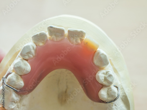 Zahntechnik Zahnprothese