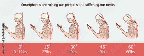 The bad smartphone postures,the angle of bending head related to the pressure on the spine, vector flat cartoon illustration. Man with phone with neck pain isolated on white background stock vector