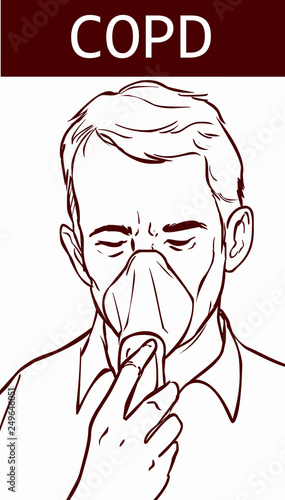  COPD (Chronic Obstructive Pulmonary Disease)