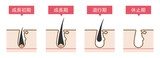 脱毛の毛周期シンプルかわいい説明図イラスト