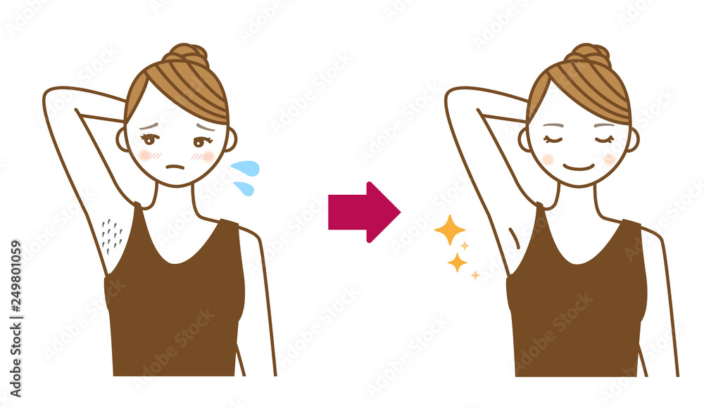ワキのムダ毛の脱毛ビフォーアフターイラスト Stock Illustration Adobe Stock