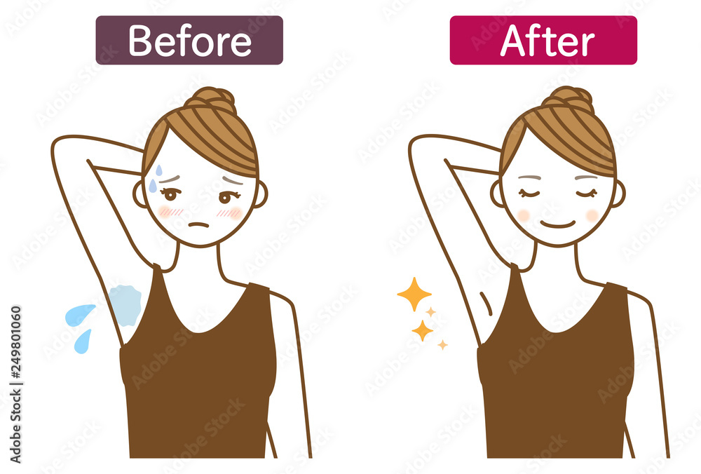 多汗症改善のビフォーアフターイラスト Stock Illustration Adobe Stock