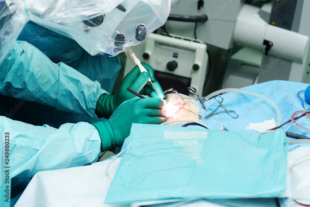 Ταπετσαρία neurosurgeons perform surgery to excise a brain tumor in a modern surgical opera