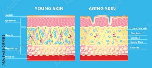 The diagram of younger skin and aging skin photo