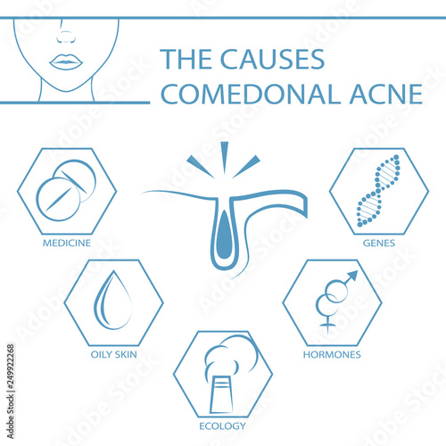 Causes of acne. Dermatology, skin problems, comedonal acne. Causes of black acne on the face. Vector illustration.
