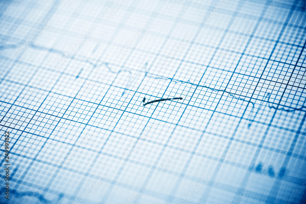 Electrocardiogram close up Electrocardiogram close up