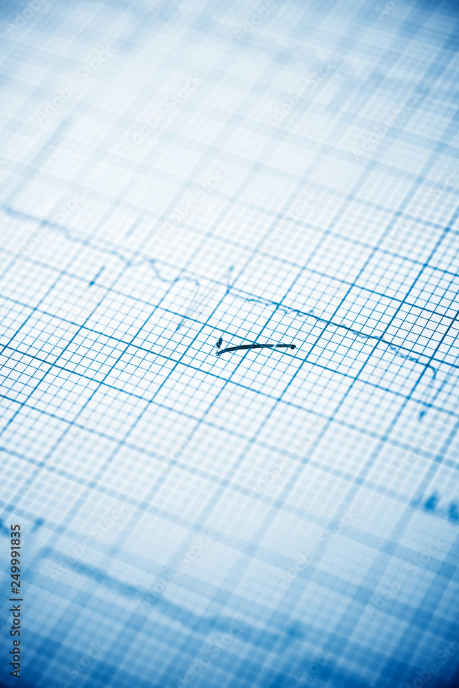 Electrocardiogram close up Electrocardiogram close up