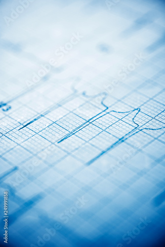 Wallpaper Mural Electrocardiogram close up Torontodigital.ca