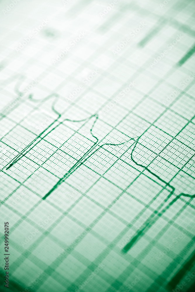 Electrocardiogram close up Electrocardiogram close up