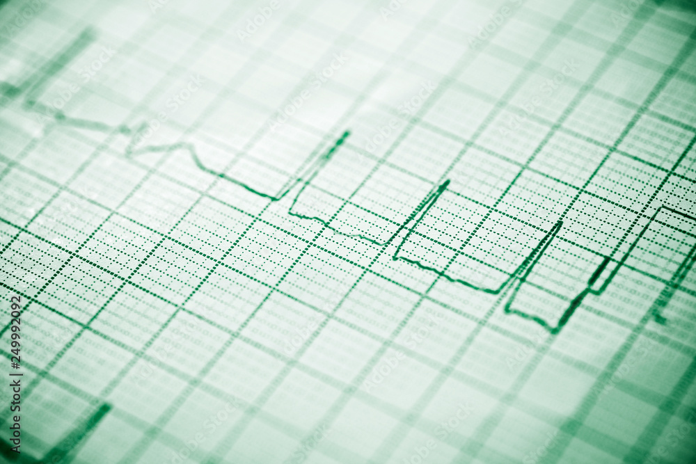Electrocardiogram close up Electrocardiogram close up