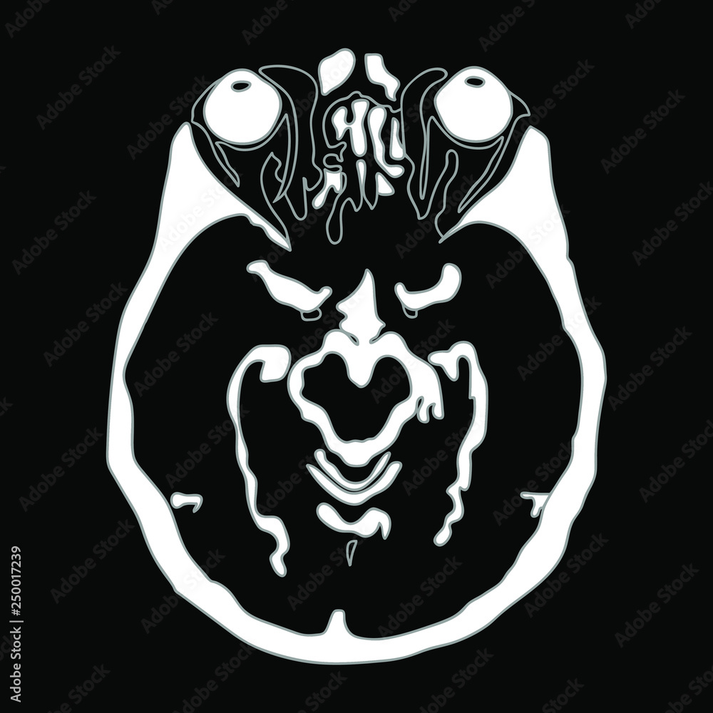 Vector cartoon illustration - photo of the brain Vector cartoon illustration - photo of the brain