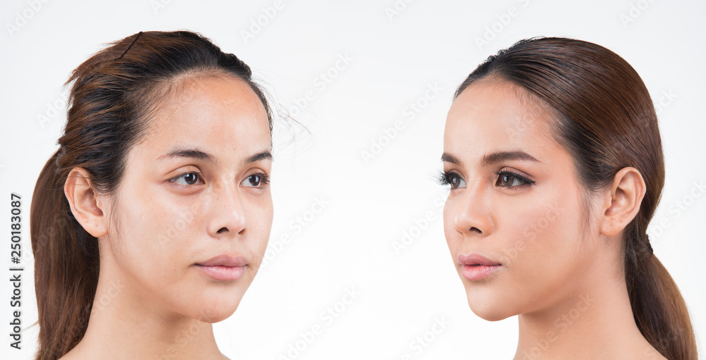 Asian Woman before after applying make up hair style. no retouch, fresh face with acne, lips, eyes, cheek, nice smooth skin. Studio lighting white background, for aesthetics therapy treatment Asian Woman before after applying make up hair style. no retouch, fresh face with acne, lips, eyes, cheek, nice smooth skin. Studio lighting white background, for aesthetics therapy treatment