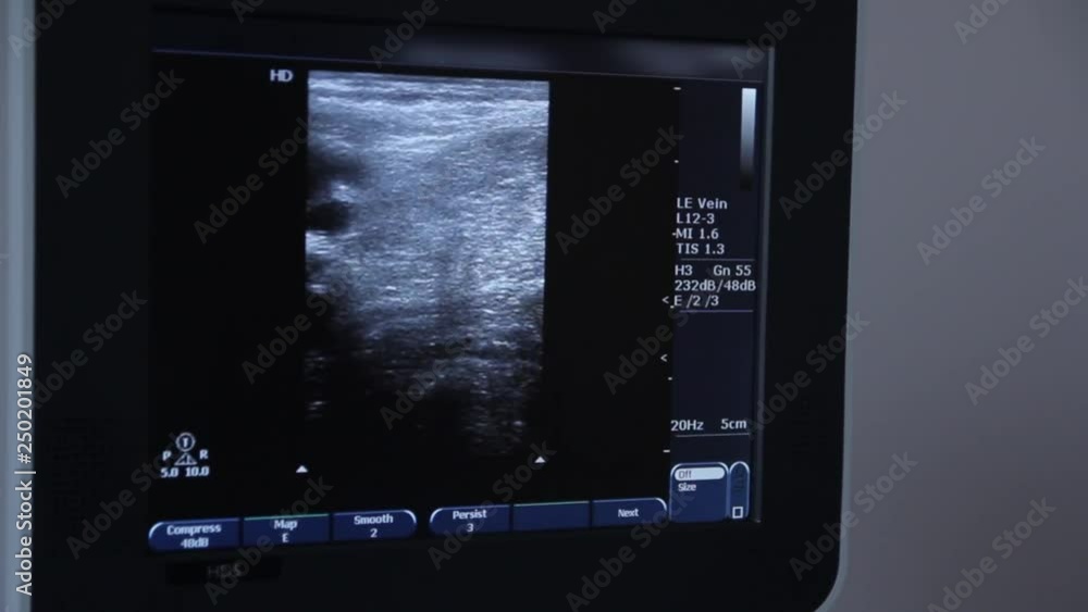 Close-up screen and ultrasound machine. Image of human organs on the display ultrasound system. Modern clinic. Close-up screen and ultrasound machine. Image of human organs on the display ultrasound system. Modern clinic.