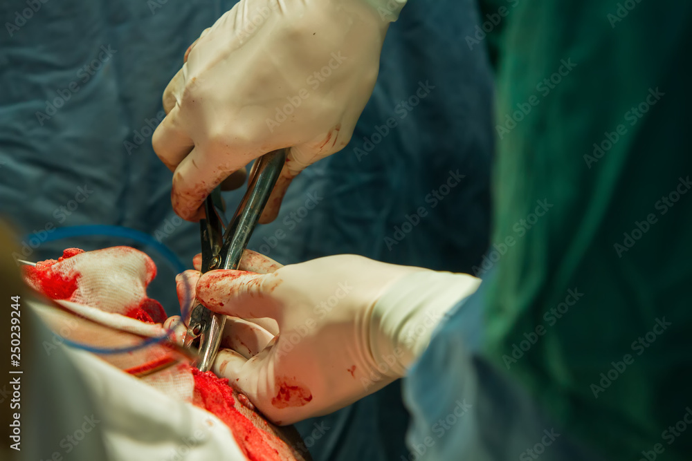 Close-up of a surgeon's hand with tongs breaking a skull bone. Close-up of a surgeon's hand with tongs breaking a skull bone.
