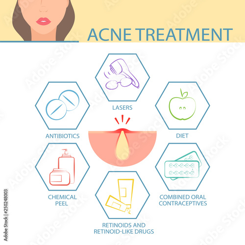 Treatment options for skin problems on the face. Treatment of problems with the skin of the face. Acne treatment infographics. Vector illustration.