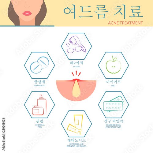 Treatment options for skin problems on the face. Treatment of problems with the skin of the face. Acne treatment infographics. Vector illustration.