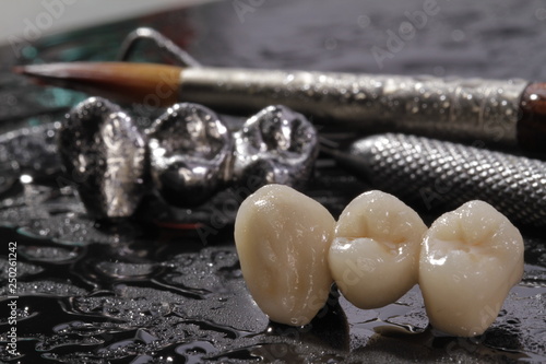 Close-up E-max pressed ceramic bridge and metal crown with dentistry utensils