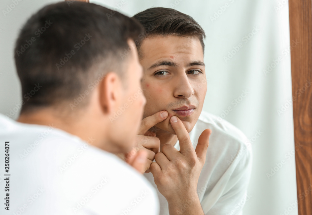 Portrait of young man with acne problem squishing pimples at home Portrait of young man with acne problem squishing pimples at home