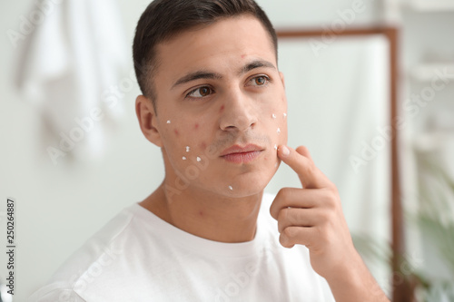 Portrait of young man using remedy for acne at home