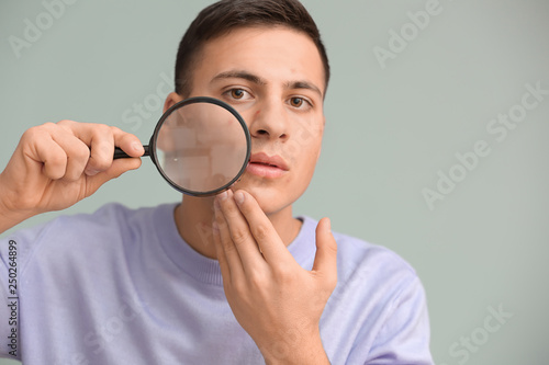 Portrait of young man with acne problem and magnifier on grey background