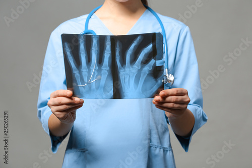 Female doctor studying X-ra...