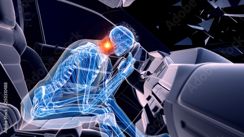 3d rendered illustration of two colliding cars - illustrating the effect of an impact without airbag