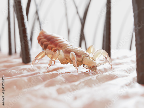 3d rendered illustration of a head louse photo