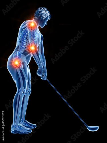 3d rendered medically accurate illustration of the skeleton of a golf player with painful joints