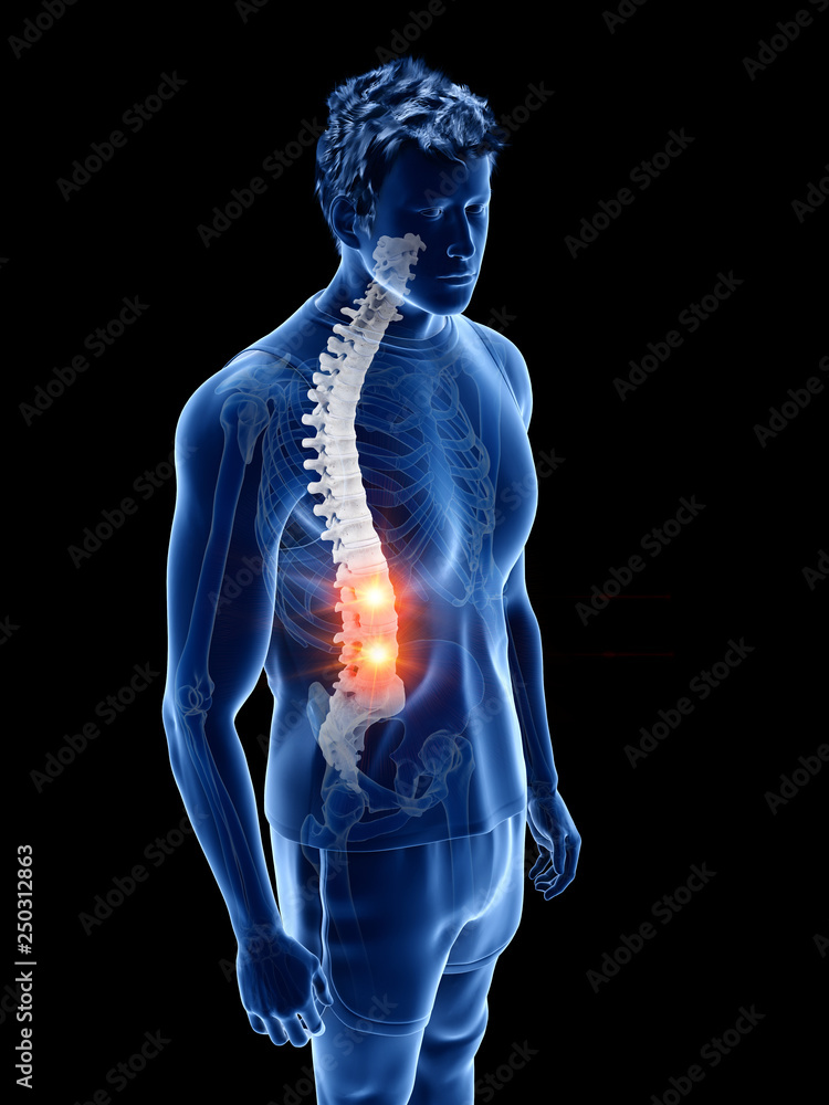 3d rendered medically accurate illustration of a man having back pain 3d rendered medically accurate illustration of a man having back pain