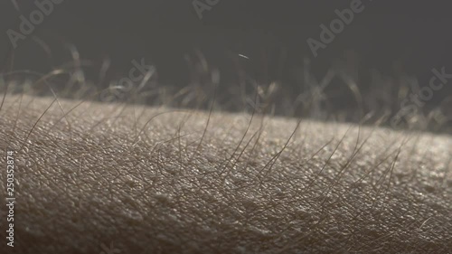 Goosebumps macro. Hair on the hand rise up. Skin reaction to cold, fear, or good music. Horripilation on skin. photo