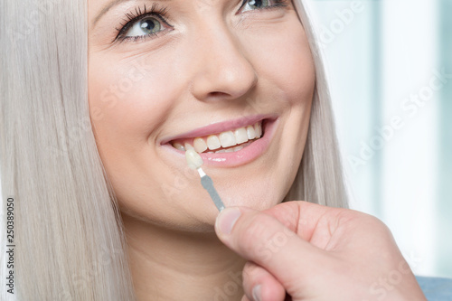 Using a shade guide at womans mouth to check veneer of tooth crown