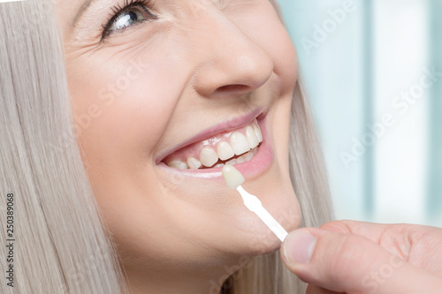 Using shade guide at mouth of smiling woman to check veneer of tooth crown