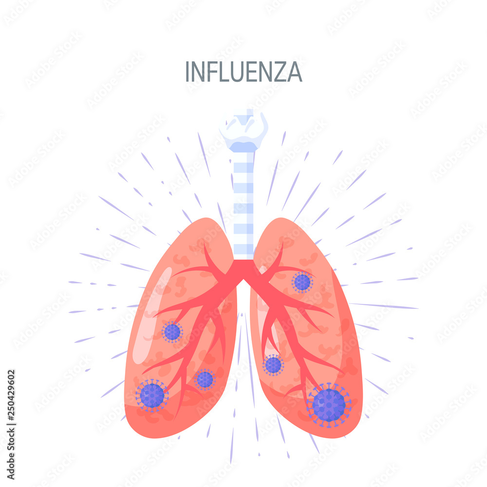 Influenza disease vector icon in flat style Influenza disease vector icon in flat style