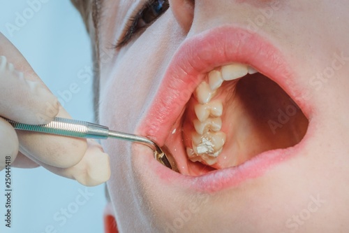 dental dentist boy patient medical. oral.