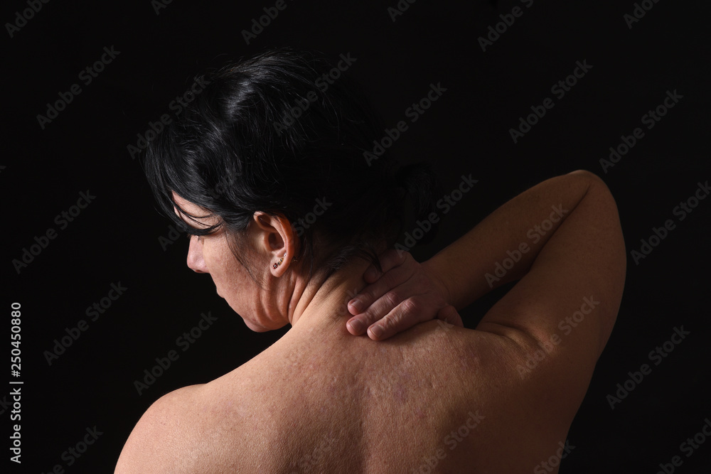 middle-aged woman with pain in the neck on black background middle-aged woman with pain in the neck on black background