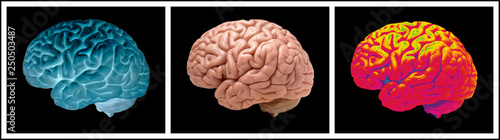 THREE PICTURE SEQUENCE OF HUMAN BRAIN