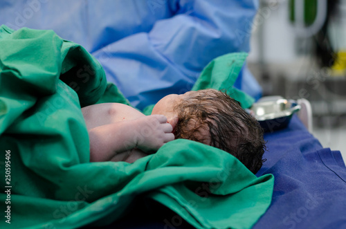 A baby recently born via cesarean section, the baby is being cleaned up by a pediatric nurse photo