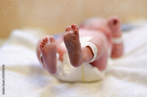 A newborn baby's feet in the neonatal unit in hospital