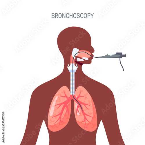 Lungs diagnostic vector design in flat style