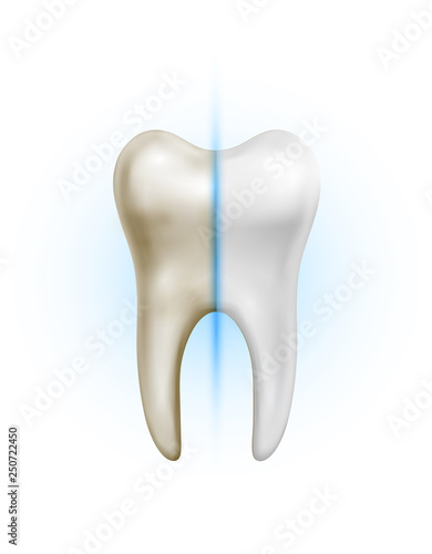 Vector dirty tooth and white clean healthy tooth comparison on white background
