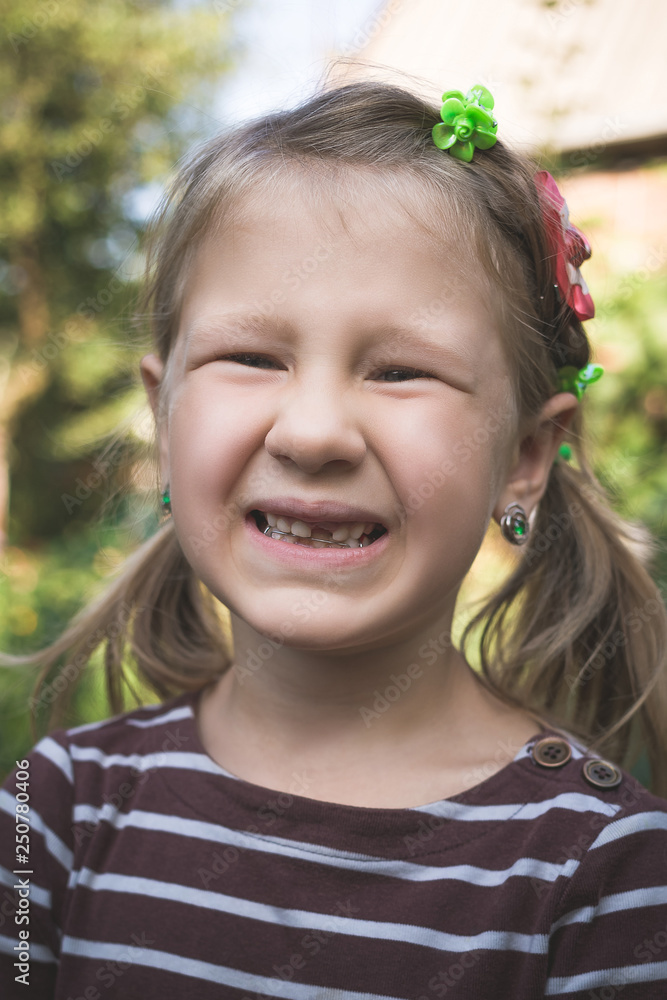 Child with a dental orthodontic device and without one tooth Child with a dental orthodontic device and without one tooth