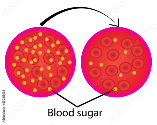 reduce blood sugar level control 