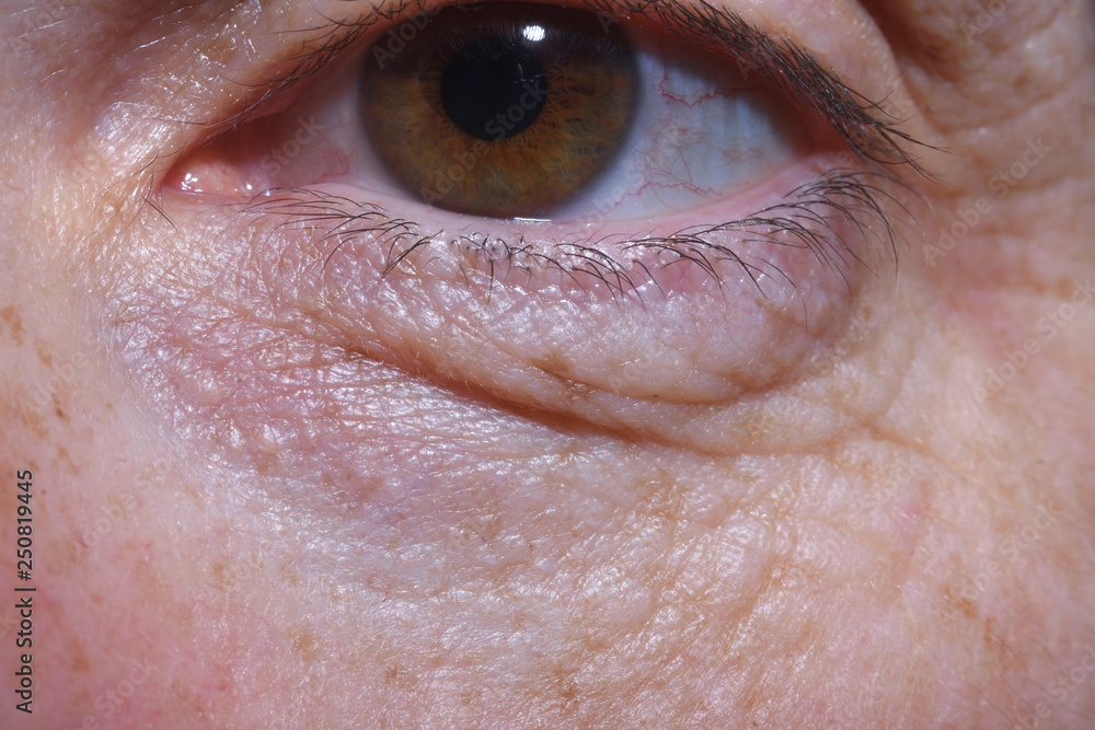 Fototapeta premium detail of eye bags and wrinkles of a middle-aged woman