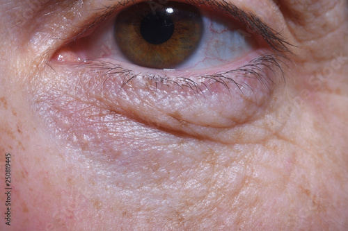 detail of eye bags and wrinkles of a middle-aged woman