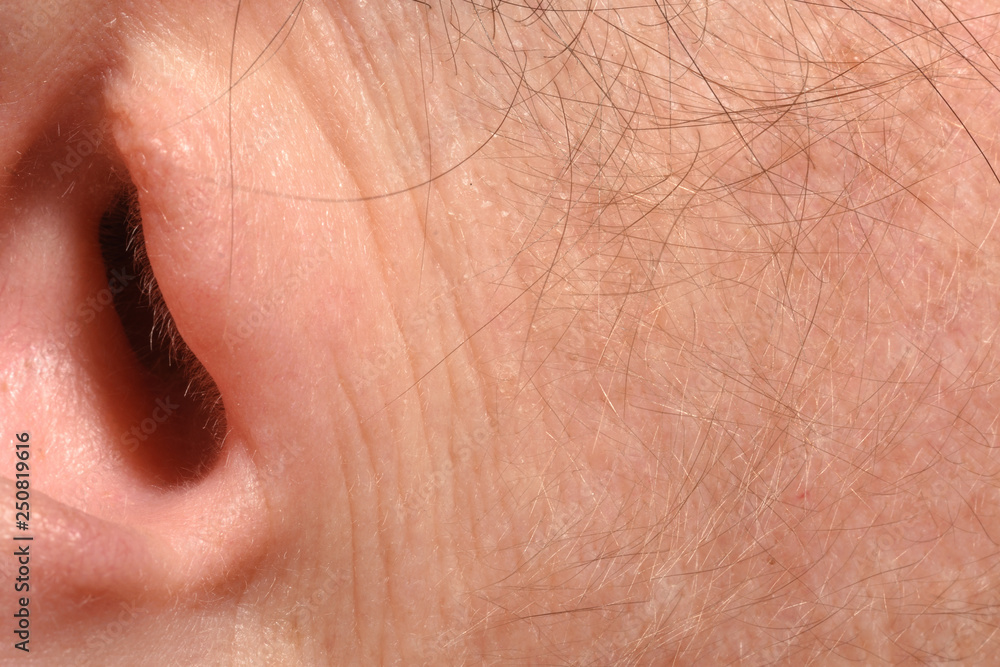 Fototapeta premium Wrinkles due to age in the ear of a 43-year-old woman