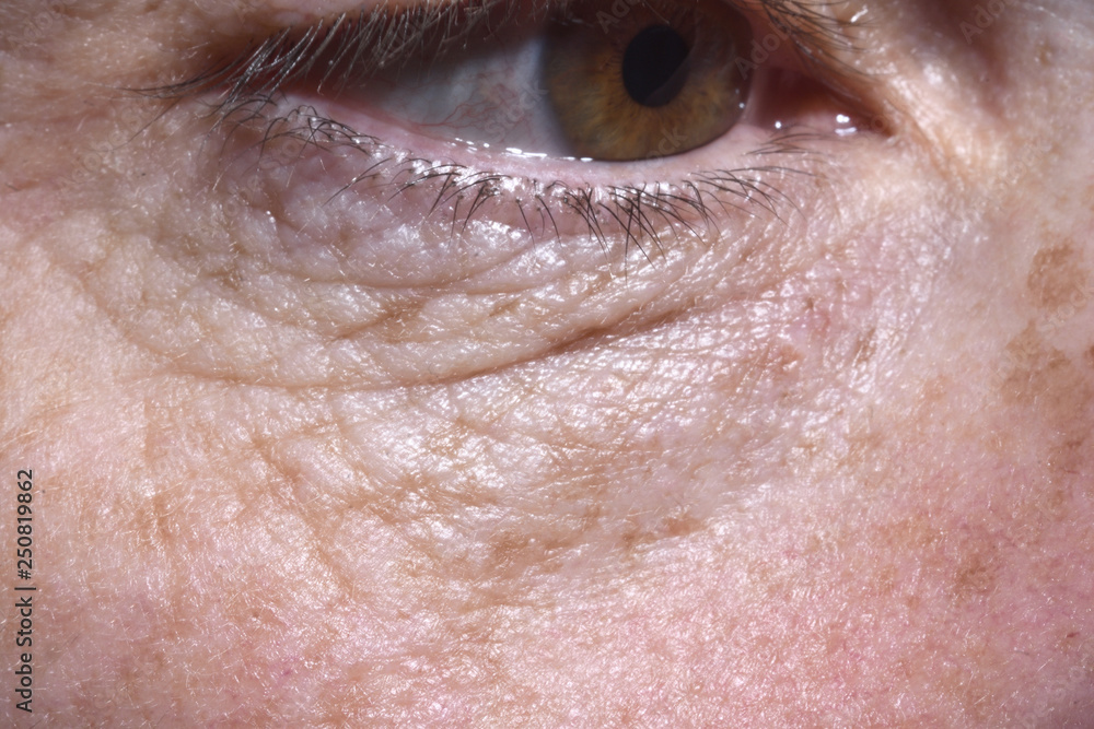 detail of eye bags and wrinkles of a middle-aged woman detail of eye bags and wrinkles of a middle-aged woman