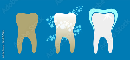 Beautiful flat dentist vector set of teeth cleansing process with decayed, cleansed and white shiny teeth on blue background.