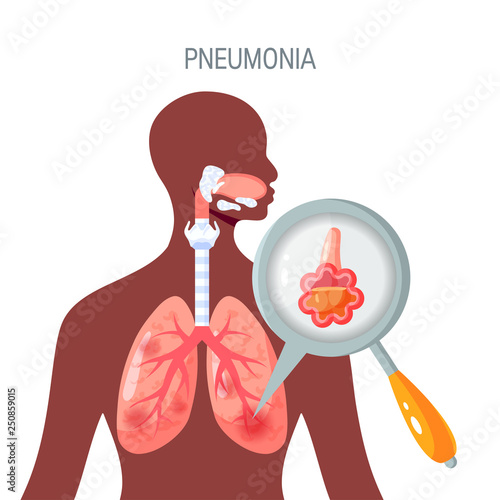 Pneumonia disease vector icon in flat style